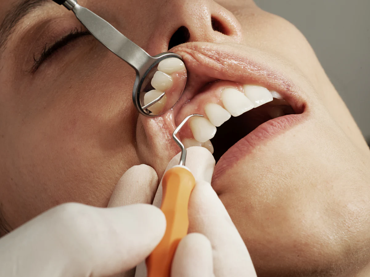 Dental implants cost Dubai